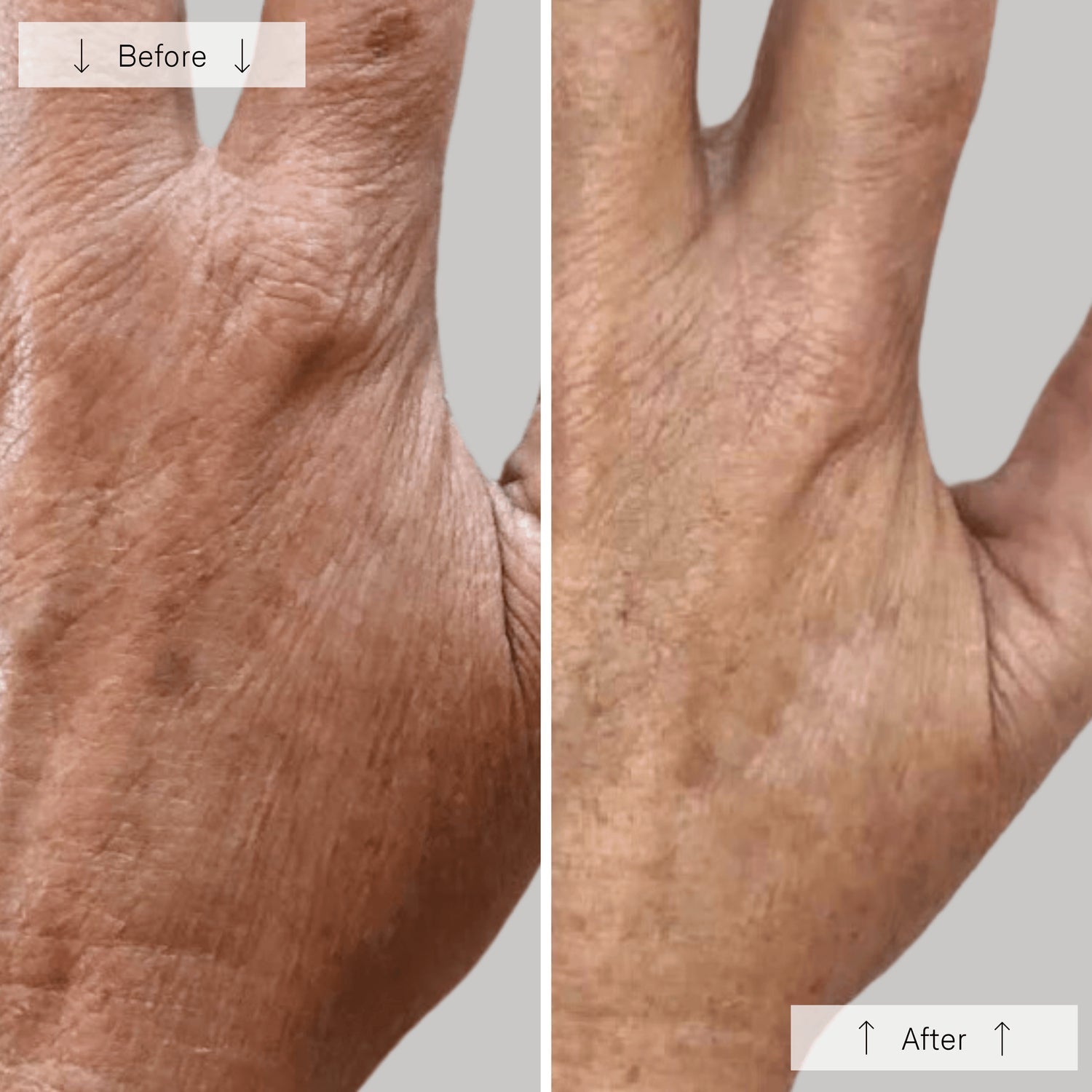 Omnilux Contour Glove – LED Light Therapy Device for Hands – Le Petit Spa