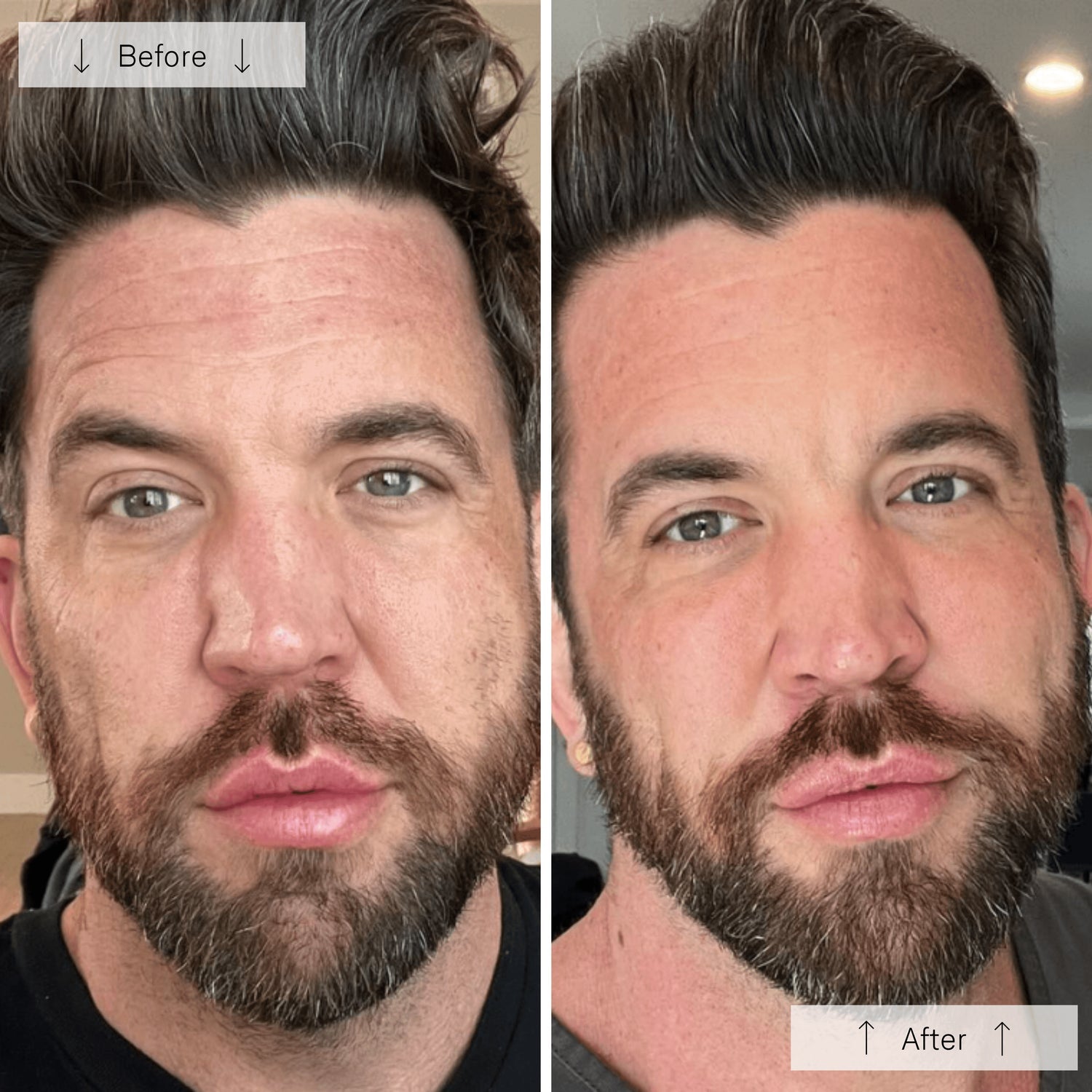 Omnilux Men – FDA-Cleared LED Light Therapy Mask for Men – Le Petit Spa