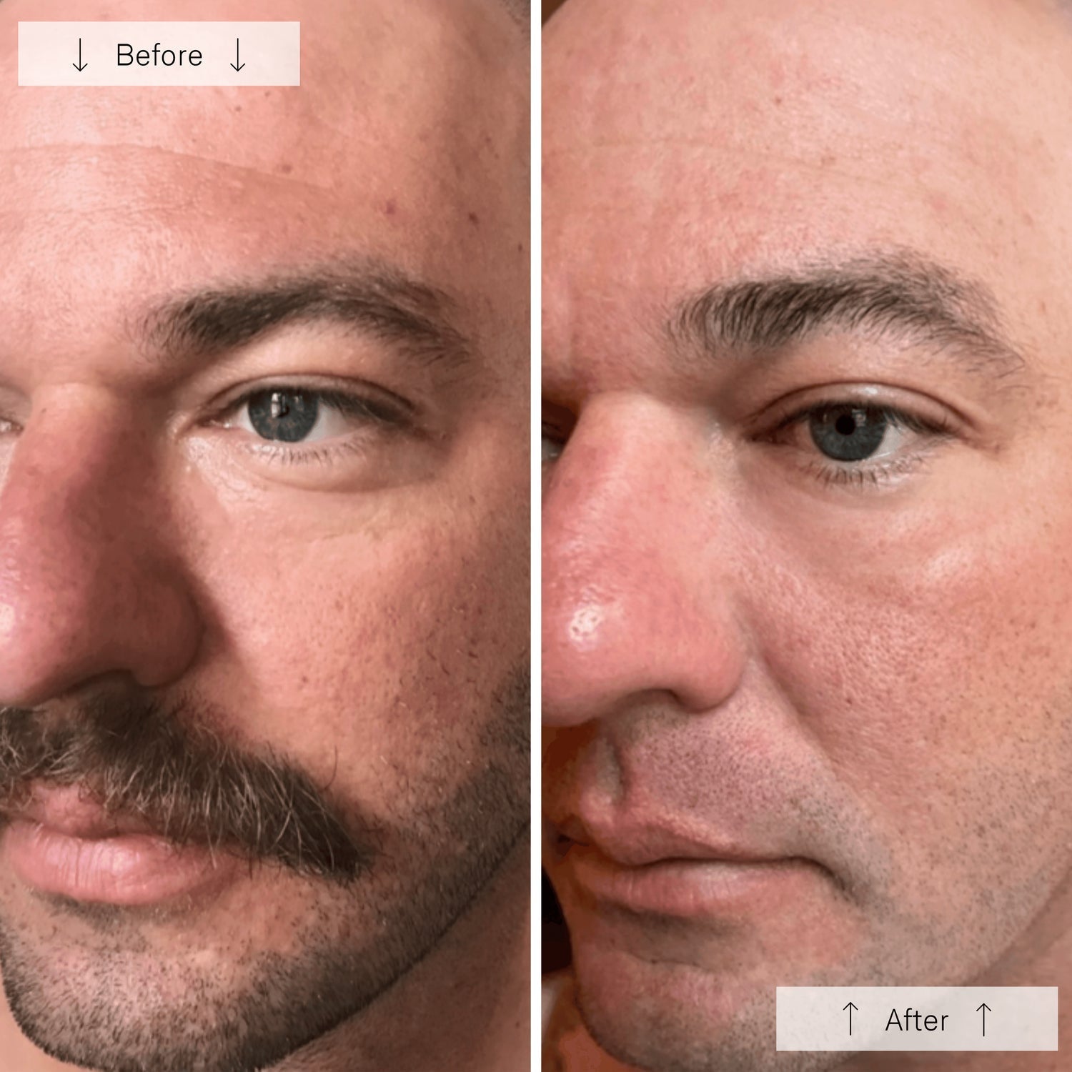 Omnilux Men – FDA-Cleared LED Light Therapy Mask for Men – Le Petit Spa