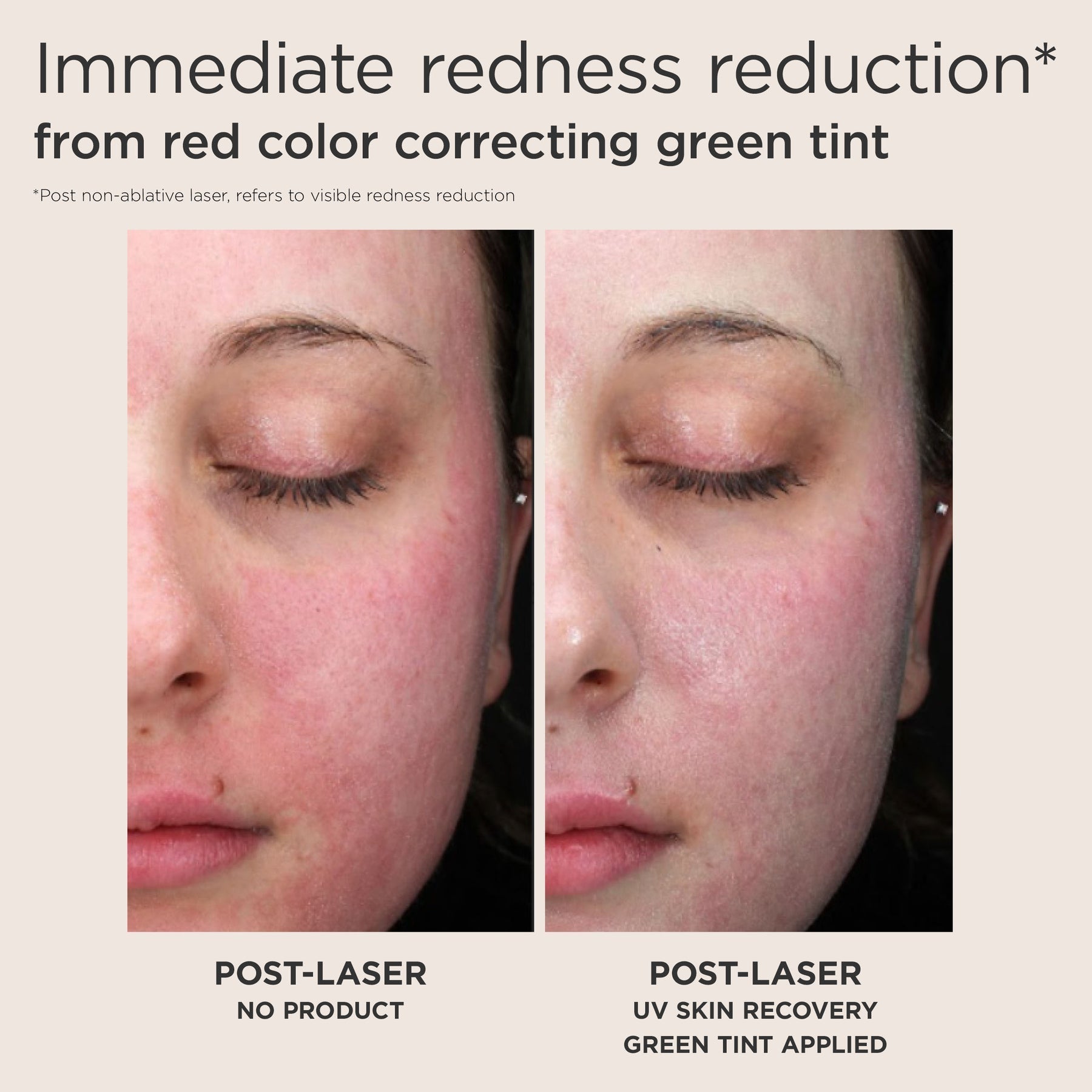EltaMD UV Skin Recovery Green Tint SPF 50 | Redness-Correcting Mineral Sunscreen