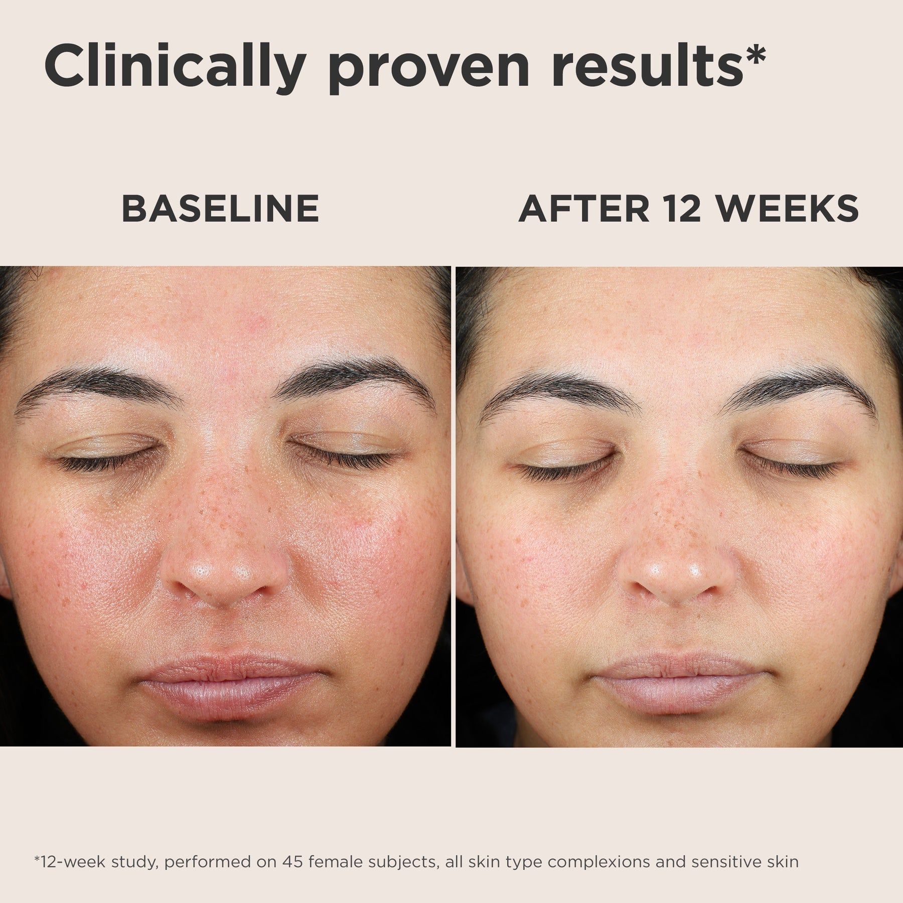 EltaMD UV Skin Recovery Green Tint SPF 50 – Redness-Correcting Mineral Sunscreen – Le Petit Spa