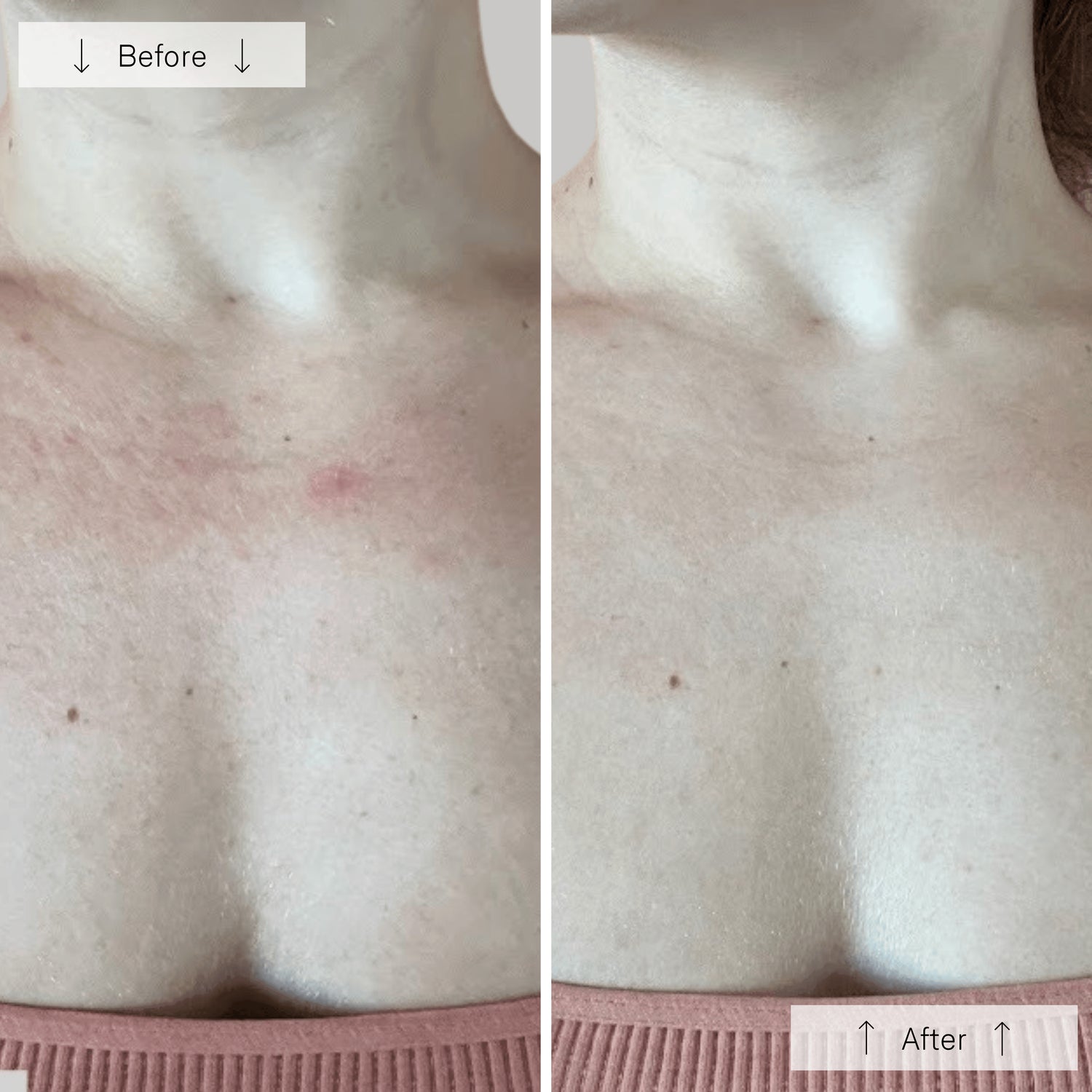 Omnilux Contour Neck & Décolleté – LED Light Therapy Device for Neck and Chest – Le Petit Spa