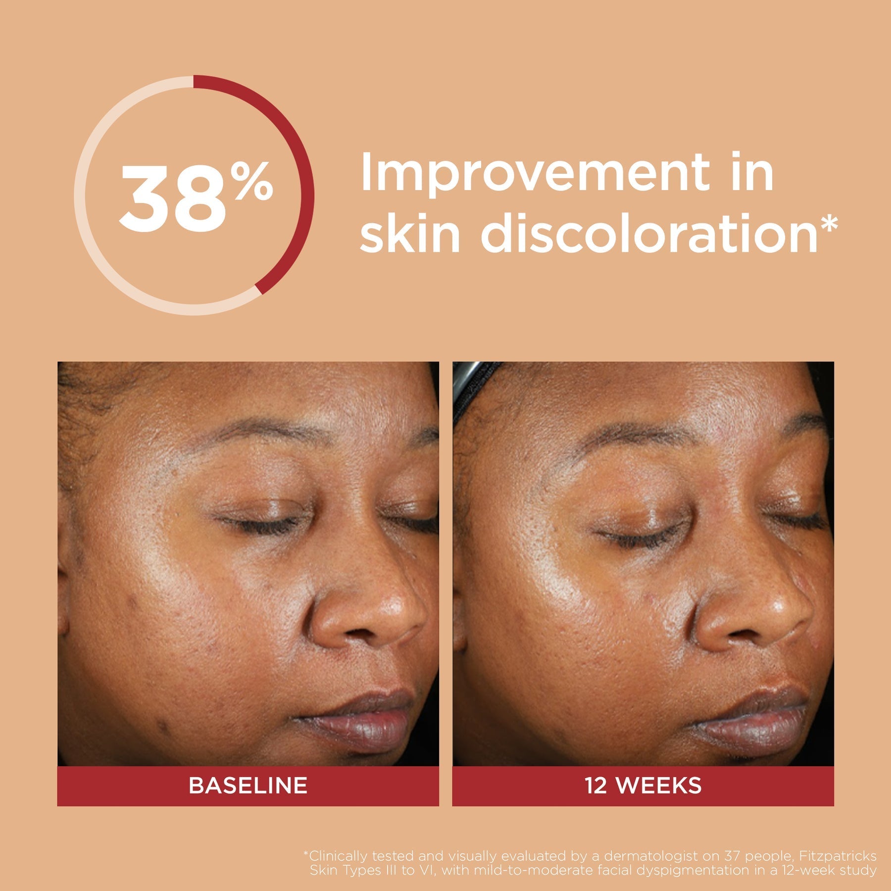 EltaMD UV Clear Deep Tinted Broad-Spectrum SPF 46 | Niacinamide SPF for Deeper Skin Tones