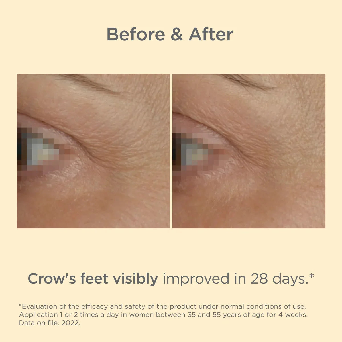 ISDIN Vital Eyes – Anti-Aging Eye Cream for Fatigue and Fine Lines (15 ml) – Le Petit Spa
