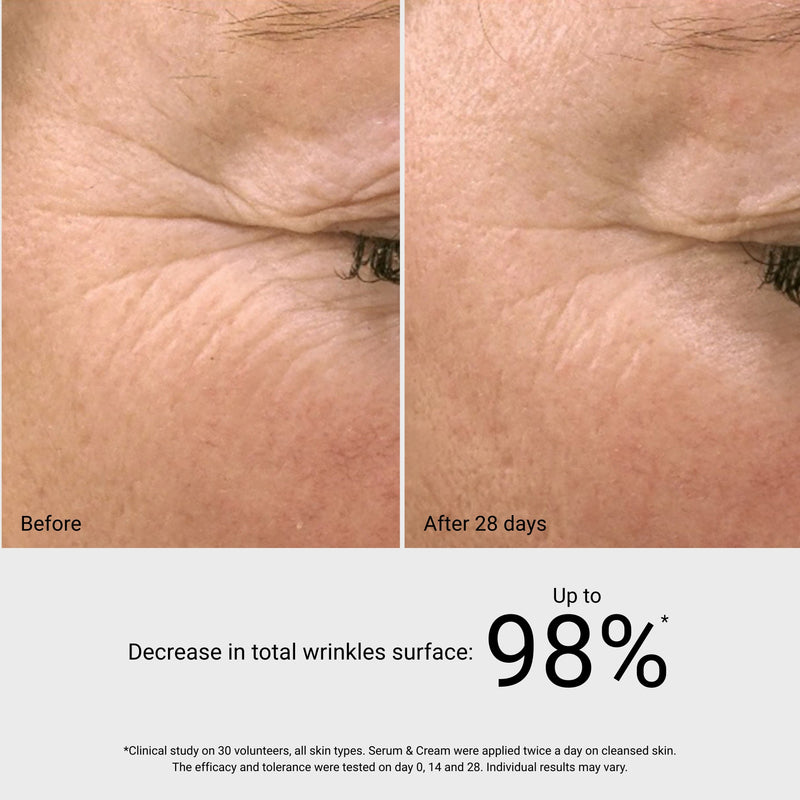 G.M. Collin GF Repair before and after results