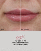 Before and after 7 days: 93 percent of 40 volunteers report lip contours are better defined, view 7